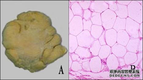 便秘有关的疾病